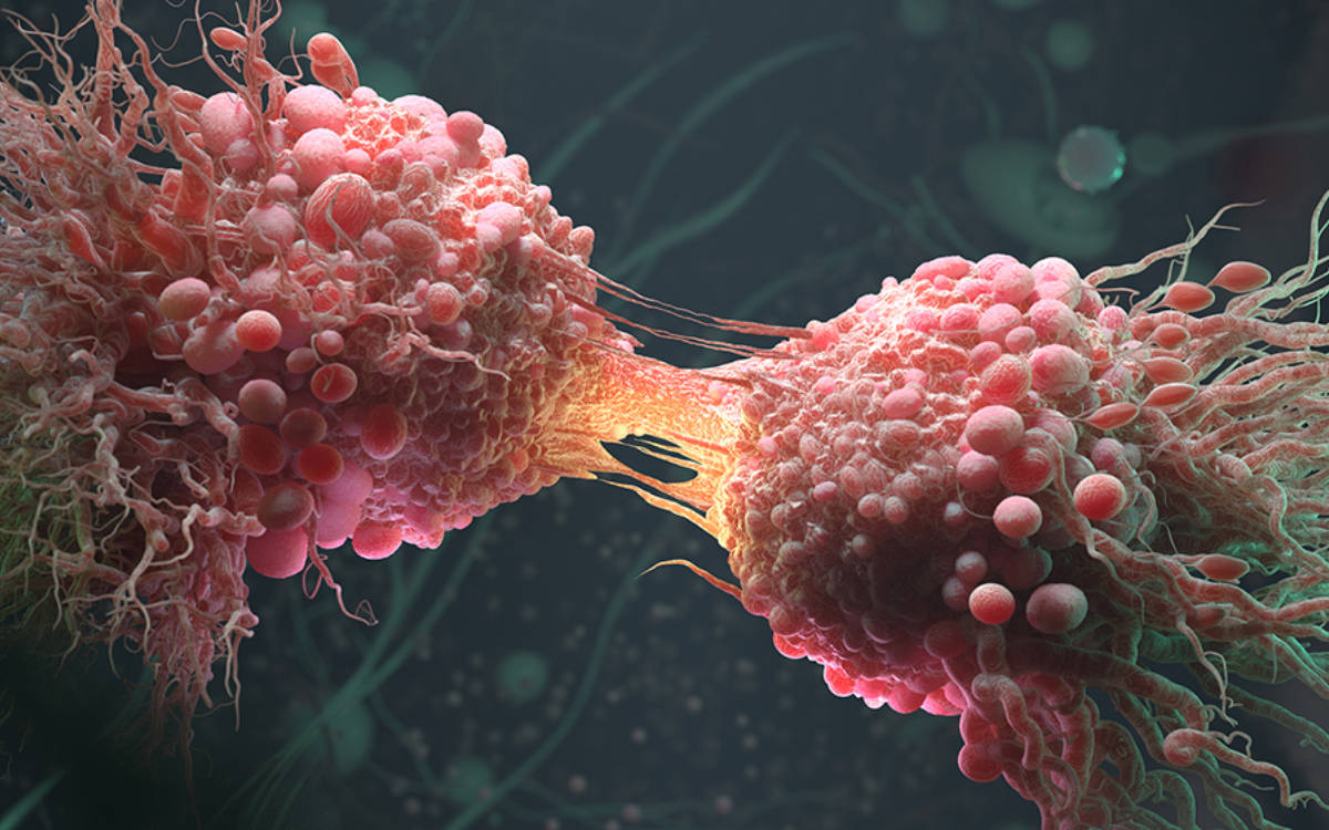 Nexweşiya penceşêrê, sedem û çareseriyên wê