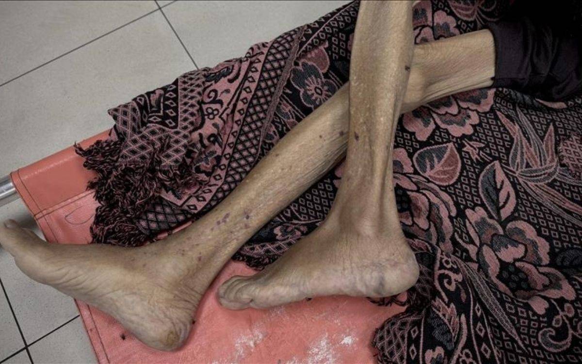 İsrail’in kıtlığa mahkum ettiği Gazze'de 3'ü çocuk 10 kişi daha açlıktan hayatını kaybetti