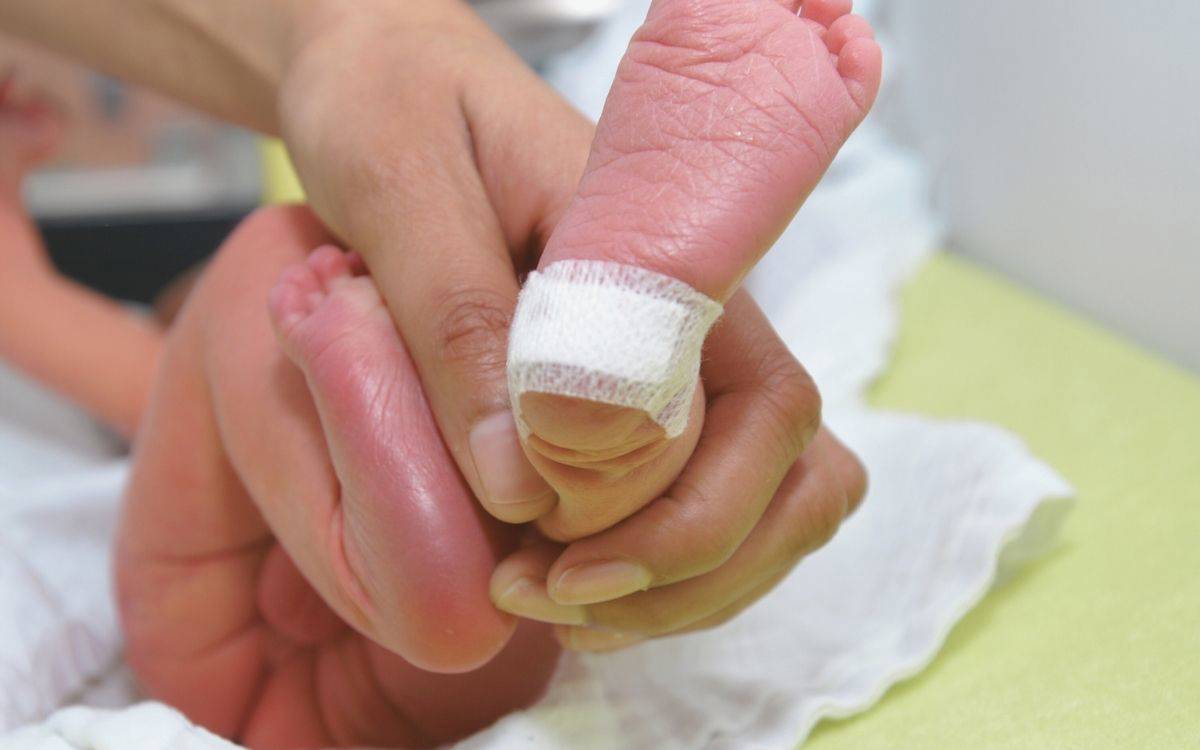 Fotoğrafta, bir sağlık personelinin yeni doğmuş bir bebeğin ayağını nazikçe tuttuğu görülüyor. Bebeğin topuğunda, muhtemelen topuk kanı testi için yapılmış olan küçük bir bandaj bulunuyor. Bebeğin cildi yumuşak ve pembe tonlarda, eller ise özenle bebeğin ayağını destekliyor. Fotoğraf, topuk kanı taraması gibi rutin bir sağlık kontrolü sırasında çekilmiş gibi görünüyor ve bebeklerin sağlık kontrollerine verilen önemi vurguluyor.