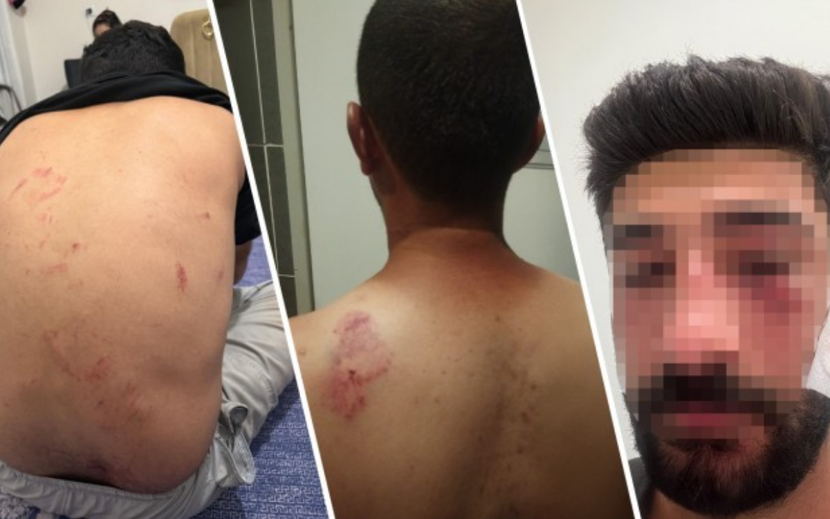 Family attacked in Mersin 'for speaking Kurdish,' one member in intensive care