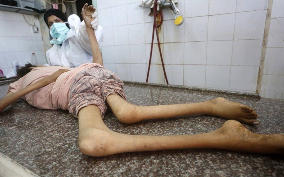 Gazze’de 24 saatte 3’ü çocuk 9 kişi açlıktan öldü