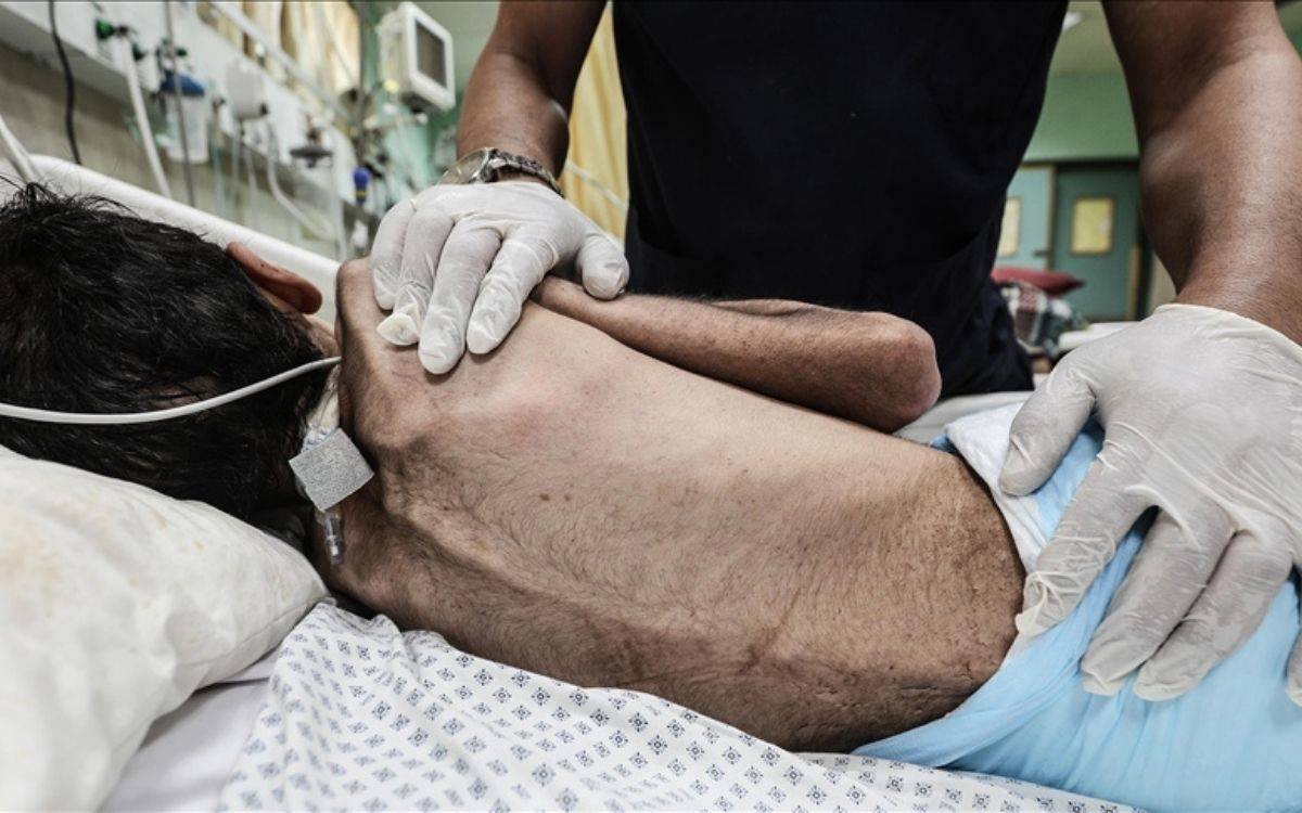 Gazze’de açlıktan ölenlerin sayısı artıyor: Son 24 saatte 5 can kaybı