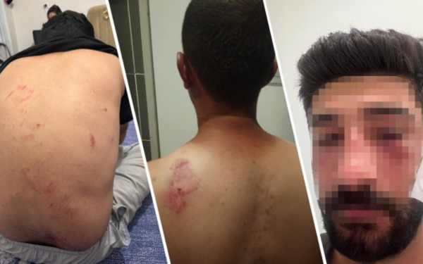 Mersin’de 8 kişilik aile, Kürtçe konuştukları için saldırıya uğradı