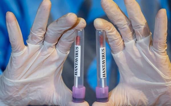 /haber/saglik-bakanligindan-hantavirus-aciklamasi-319464