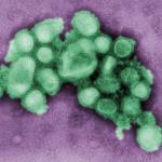/haber/2-swine-flu-patients-released-on-recovery-114711