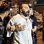 /haber/osman-erden-shares-his-police-violence-story-148495