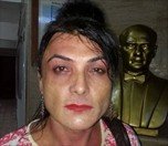 /haber/trans-aktivist-figen-hayatini-kaybetti-158065