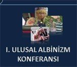 /haber/albinizm-konferansi-bu-pazar-ankara-da-158325