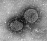 /haber/koronavirus-un-yeni-adi-covid-19-219943
