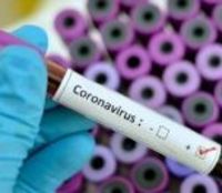/haber/turkey-s-coronavirus-cases-top-100-thousand-who-says-outbreak-stabilizing-223365