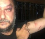 /haber/two-people-detained-over-the-attack-on-columnist-guvenc-dagustun-249579