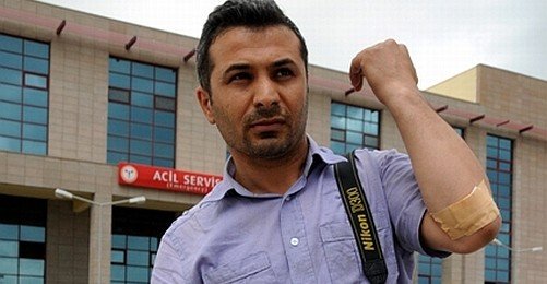 Diyarbakır'da Başbakan'ı İzleyen Gazeteci Darp Edildi