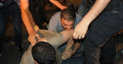 BirGün’ün “Isıran Polis” Haberi Basın Özgürlüğünün Gereği
