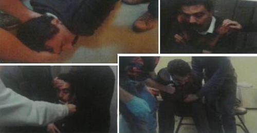 Photos Reveal Torture on Advocate Kozağaçlı 