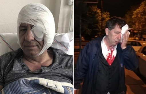 "Türkiye'de Gazetecilere Yönelik Şiddet Genellikle Cezasızlıkla Sonuçlanır"