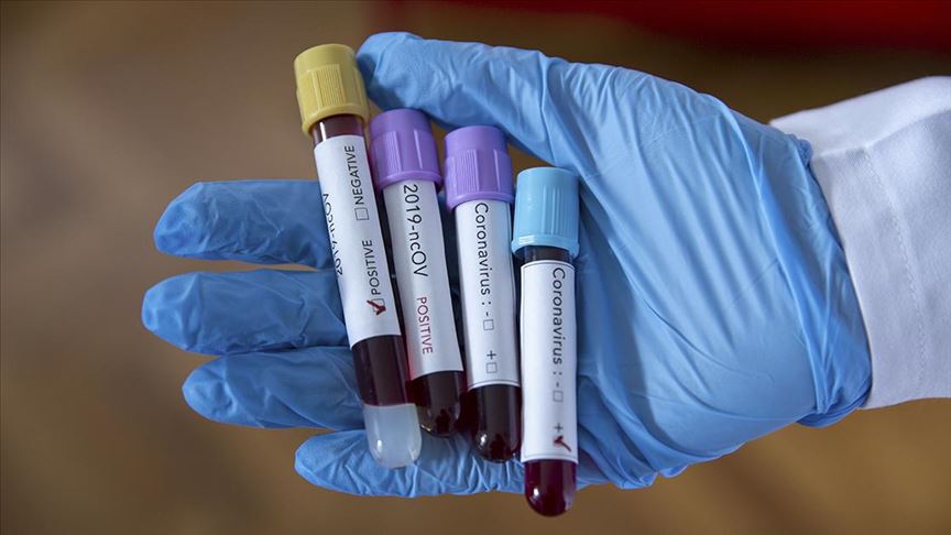 Coronavirus: Turkey Reports 2,188 Cases, 4,922 Recoveries in a Day