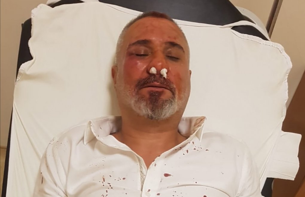 Bursa’da yerel gazeteciye saldırı