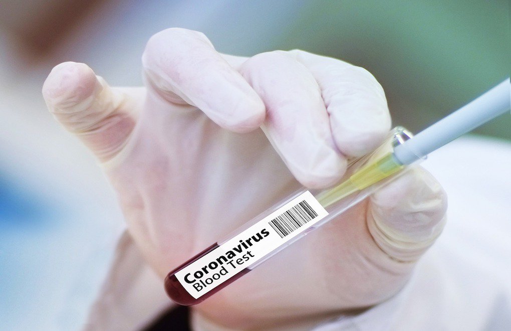 DSÖ: Covid-19 aşı sonuçları yıl sonunda ortaya çıkacak