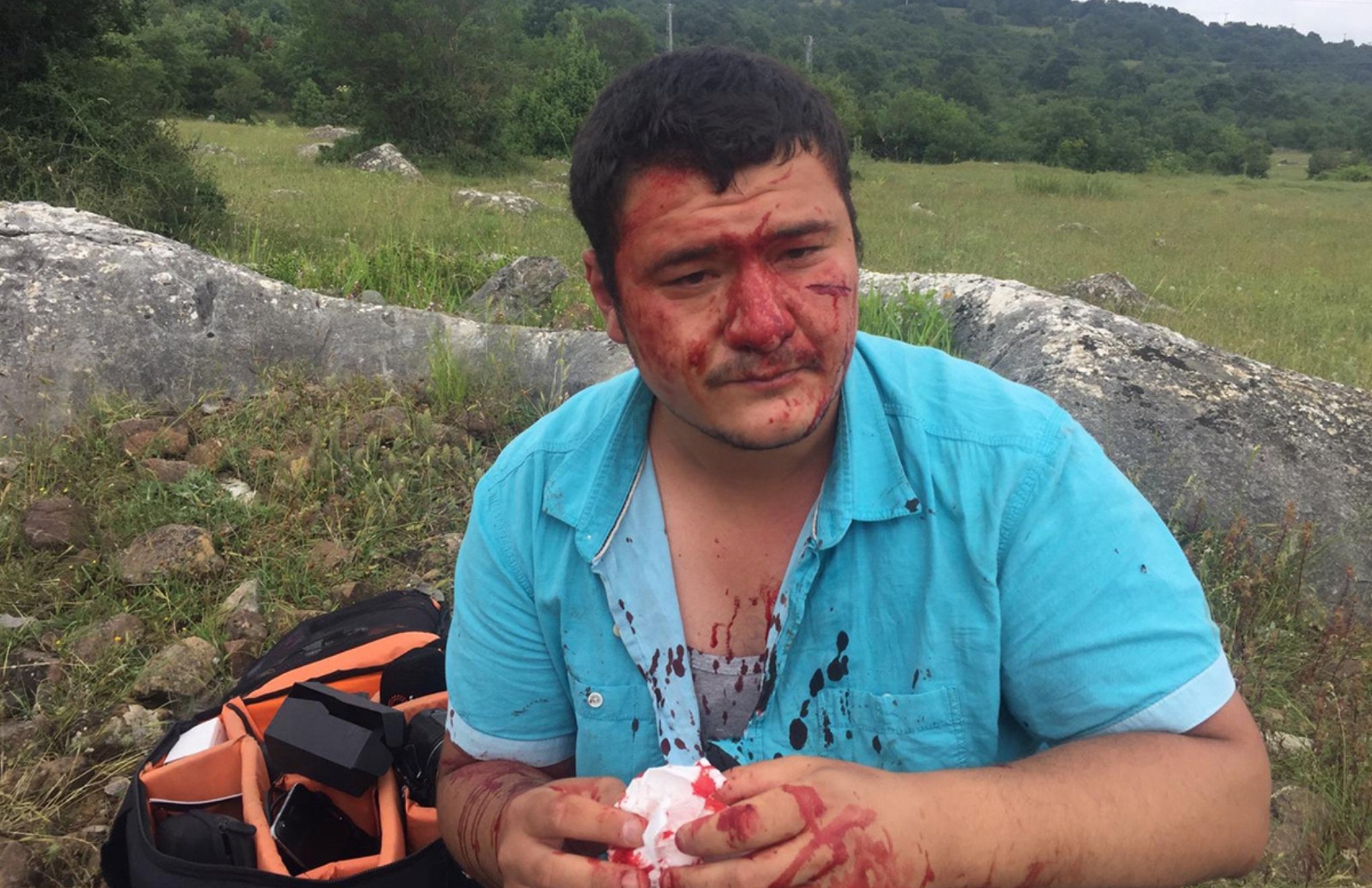İHA reporter Mustafa Uslu attacked in Kocaeli
