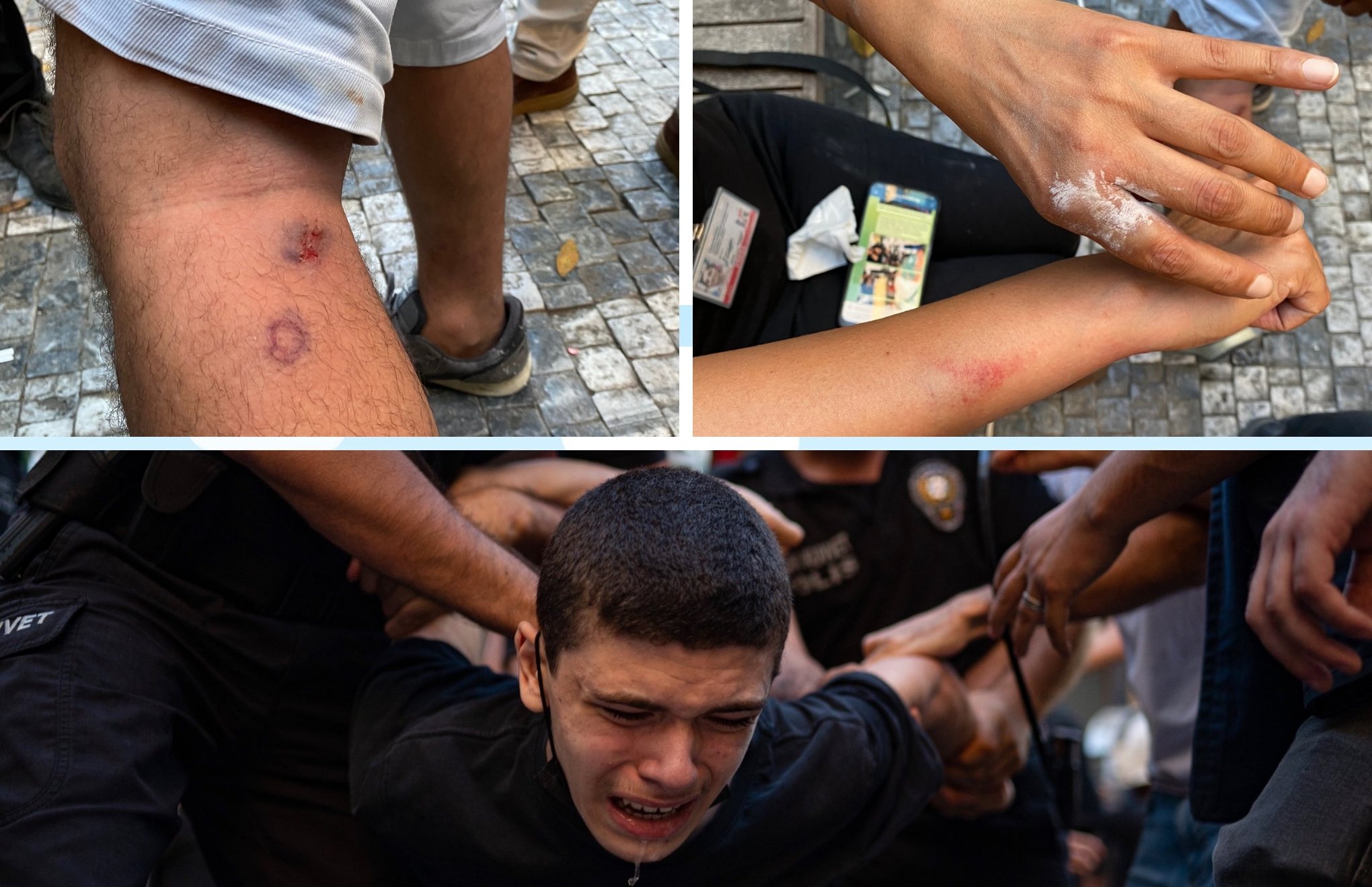 TGC gazetecilere yönelik polis şiddetini kınadı