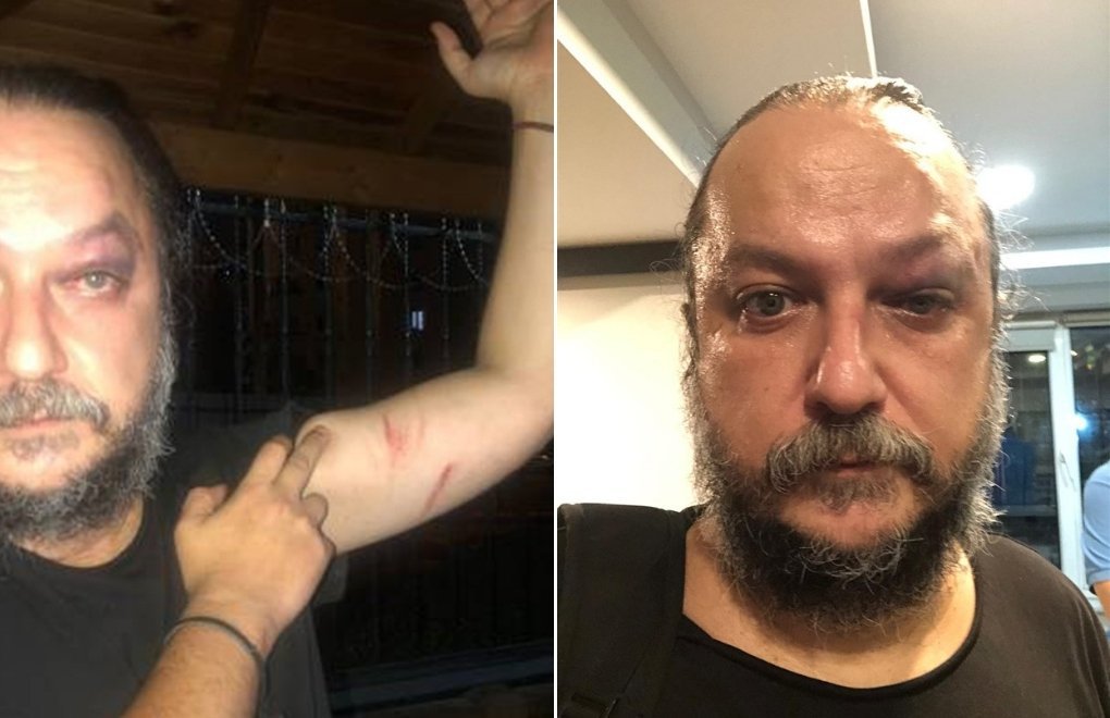 BirGün yazarı Güvenç Dağüstün’e konser sonrası saldırı
