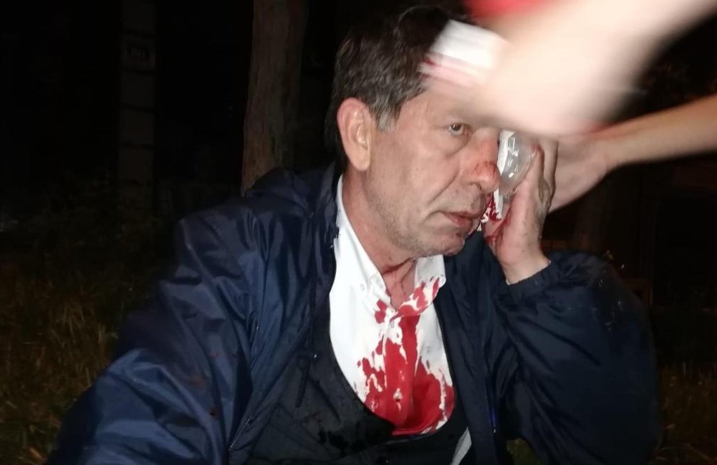 Yavuz Selim Demirağ’a saldırıda cezasızlık 4 yılı geride bıraktı