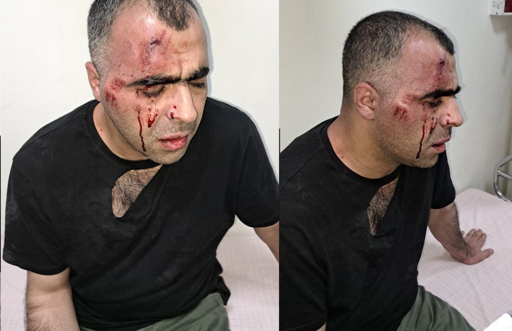 Tatvan’da gazeteciye saldıranlar ilk duruşmada tahliye edildi