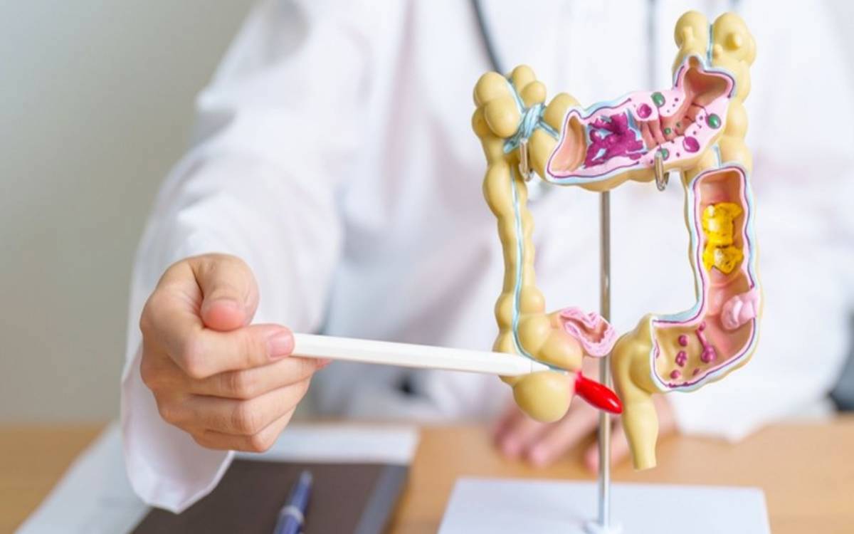 Îltihaba Roviya Zêde (Apendisitis, Îltihaba Apandîsê)